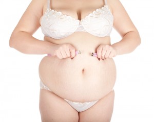 Abdominoplastia